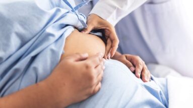 What You Need to Know About Weight Loss Surgery